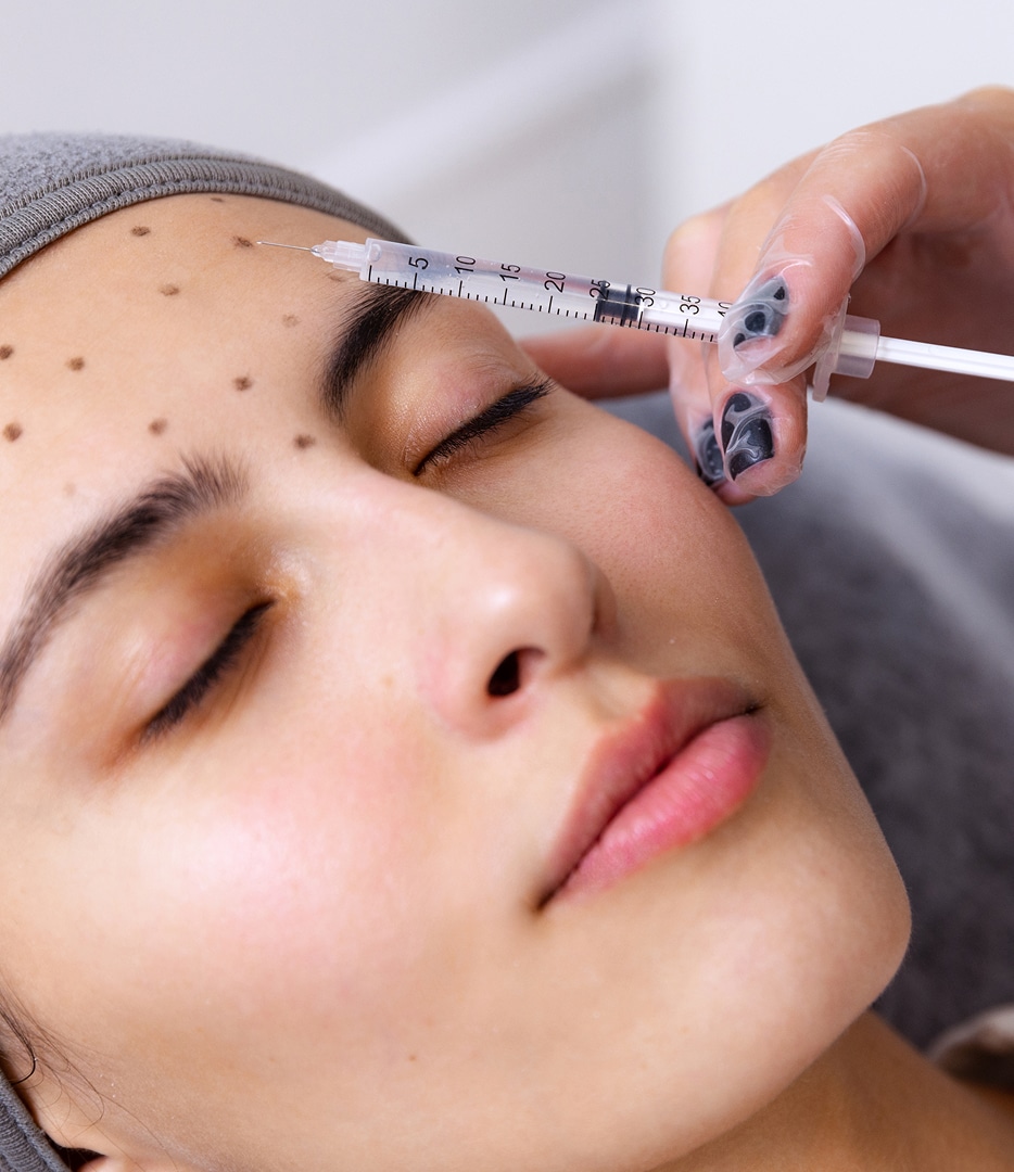 A person receiving an injectable treatment on the forehead, with dots marked for precision. The individual has their eyes closed, and the practitioner's hand is holding a syringe close to the skin.