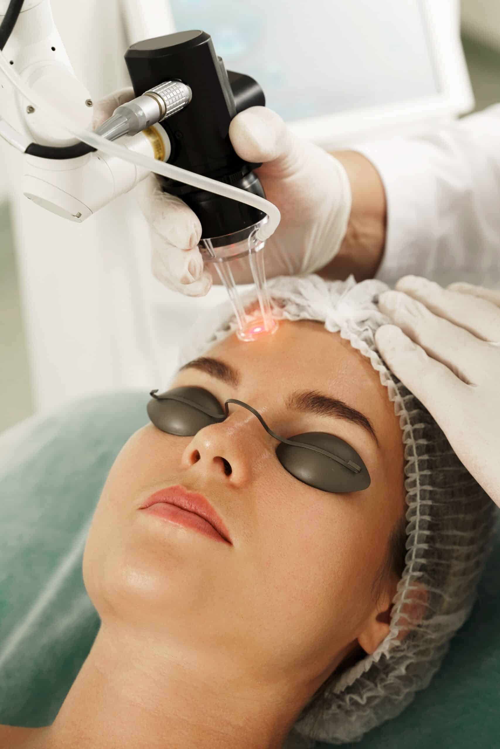 A woman receiving a laser treatment on her face while wearing protective goggles, with a technician using a handheld laser device in a clinical setting.