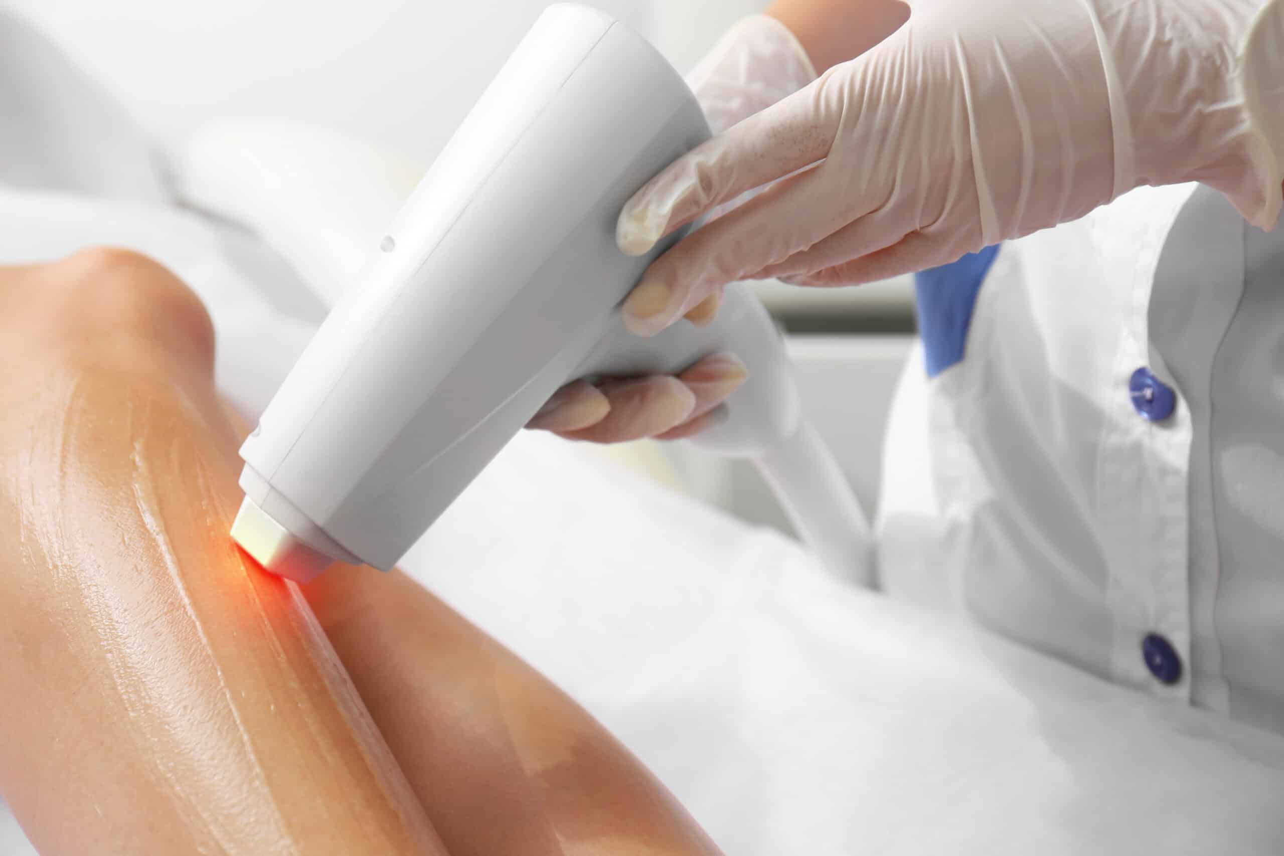 A close-up of a gloved hand using a laser device on a person's leg. The leg appears smooth and shiny, likely coated with a gel for the procedure. The setting is a clinical environment with a white backdrop.