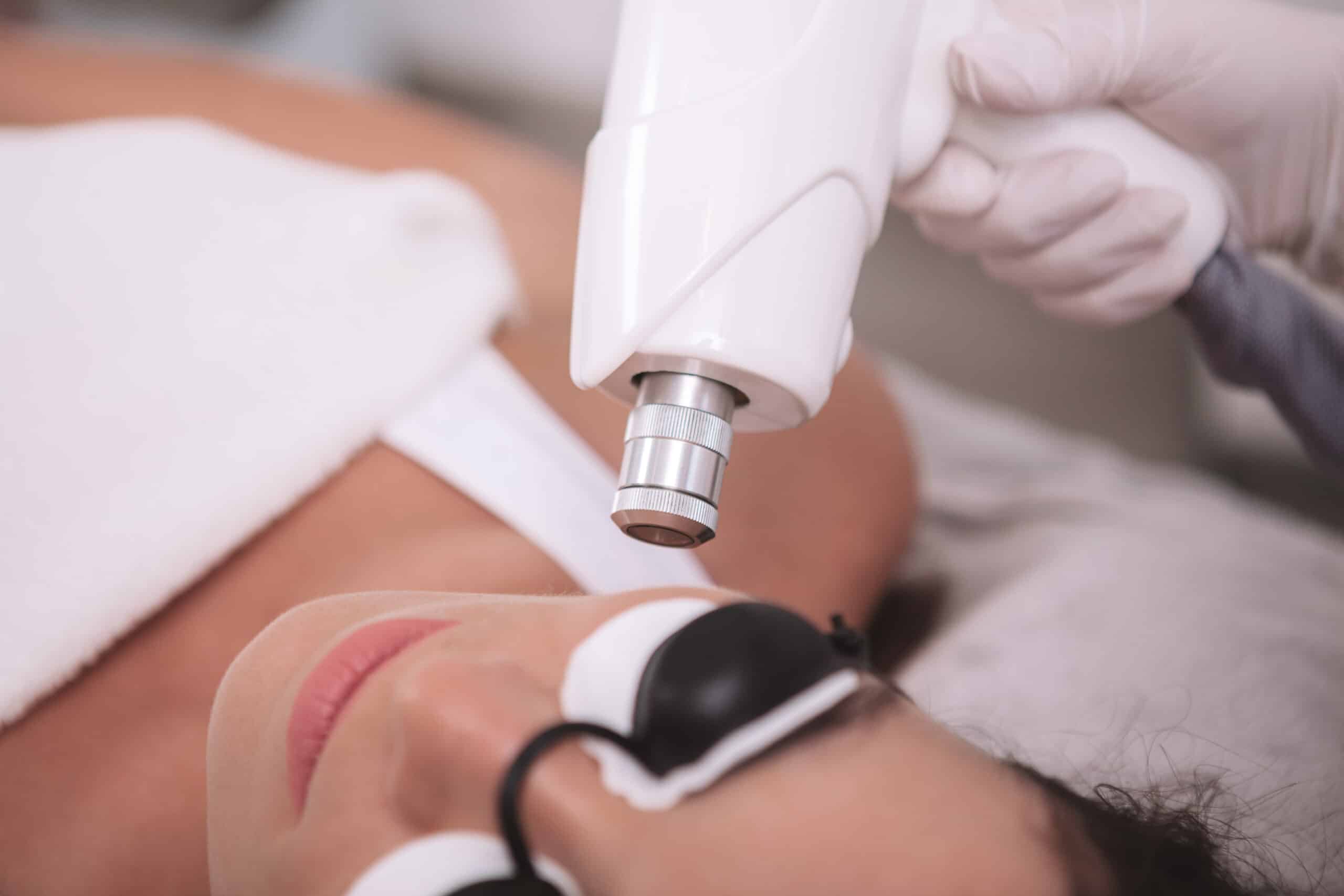 A person receiving a laser treatment in a skincare clinic. The individual is lying on a treatment bed, wearing protective goggles, and a technician is holding a laser device close to their face.