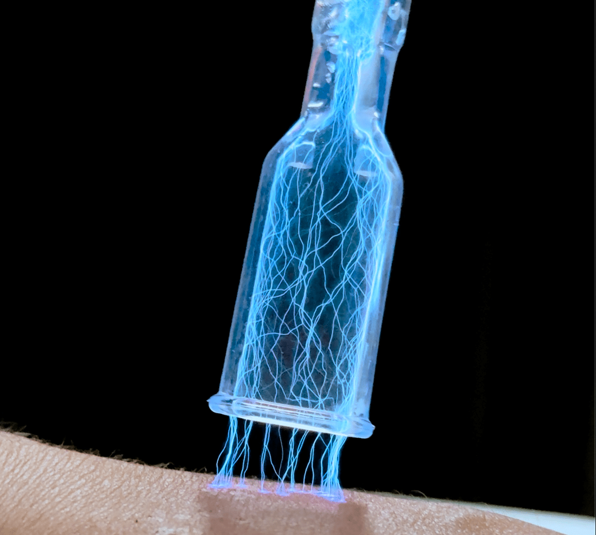A translucent bottle-shaped device is positioned above a person's skin, emitting blue electric-like tendrils that descend toward the surface. The background is dark, highlighting the device and the illuminated effects.