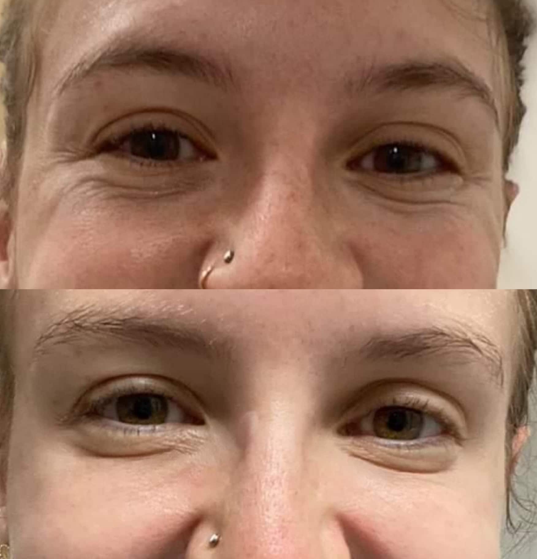 Two close-up photos show the same woman's eyes and nose with a small nose ring against a plain background.