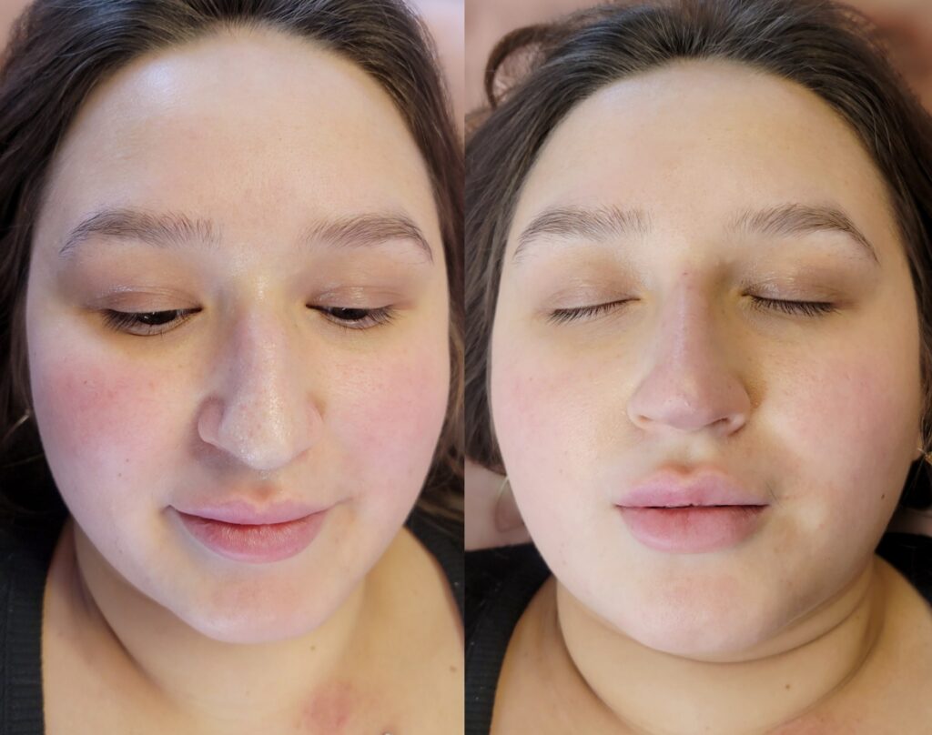 A split-screen close-up of a woman lying down with her eyes closed in both images, showing her face against a neutral background.