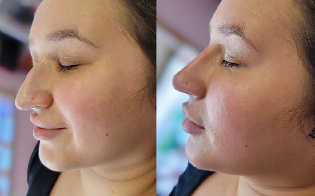Side-by-side profile close-ups of the same woman with her eyes closed, shown against a blurred indoor background.