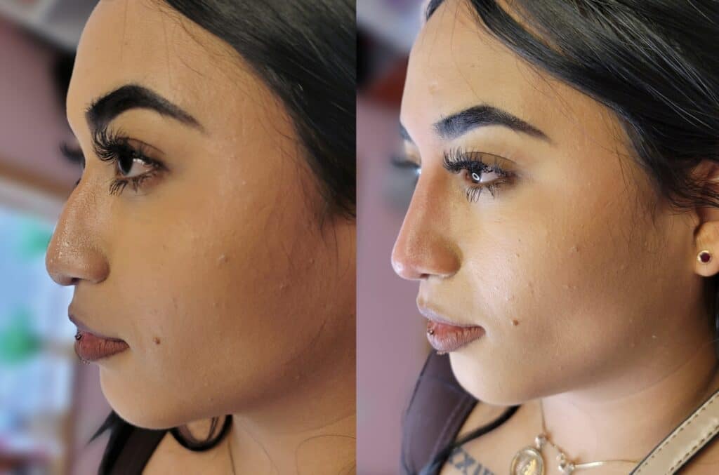 A side-by-side profile comparison of the same woman with dark hair and makeup, shown against a blurred indoor background.