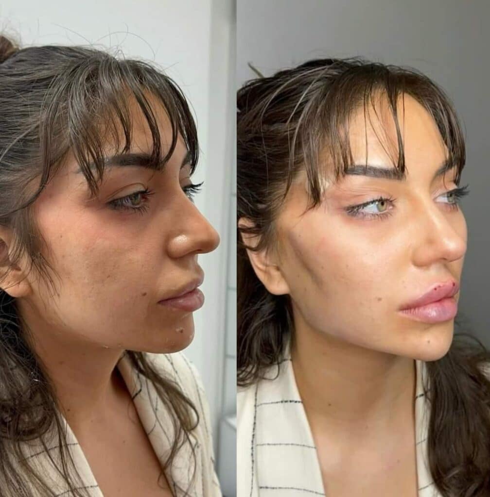 Side-by-side profile photos of a woman with dark hair and bangs, shown before and after makeup or skincare against a plain indoor background.