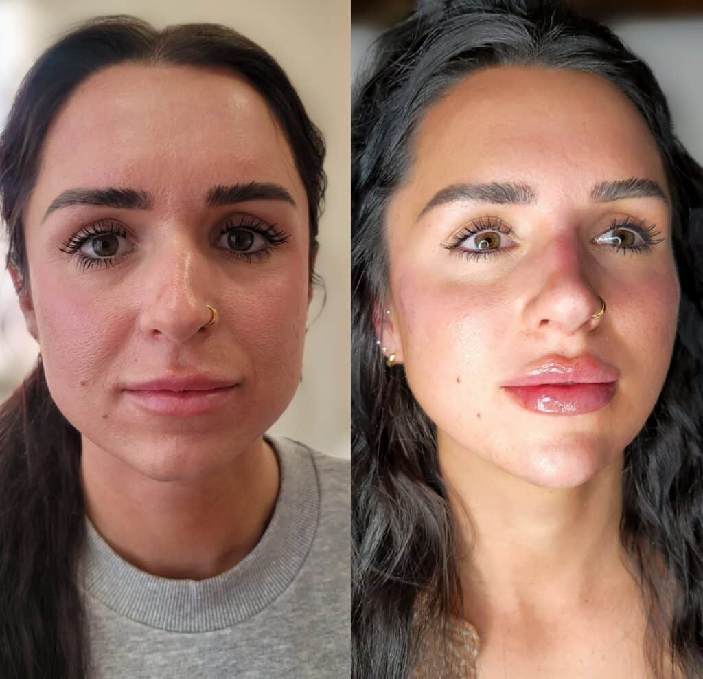 A woman appears in a side-by-side portrait comparison, with a natural look on the left and makeup, glossy lips, and highlighted skin on the right.