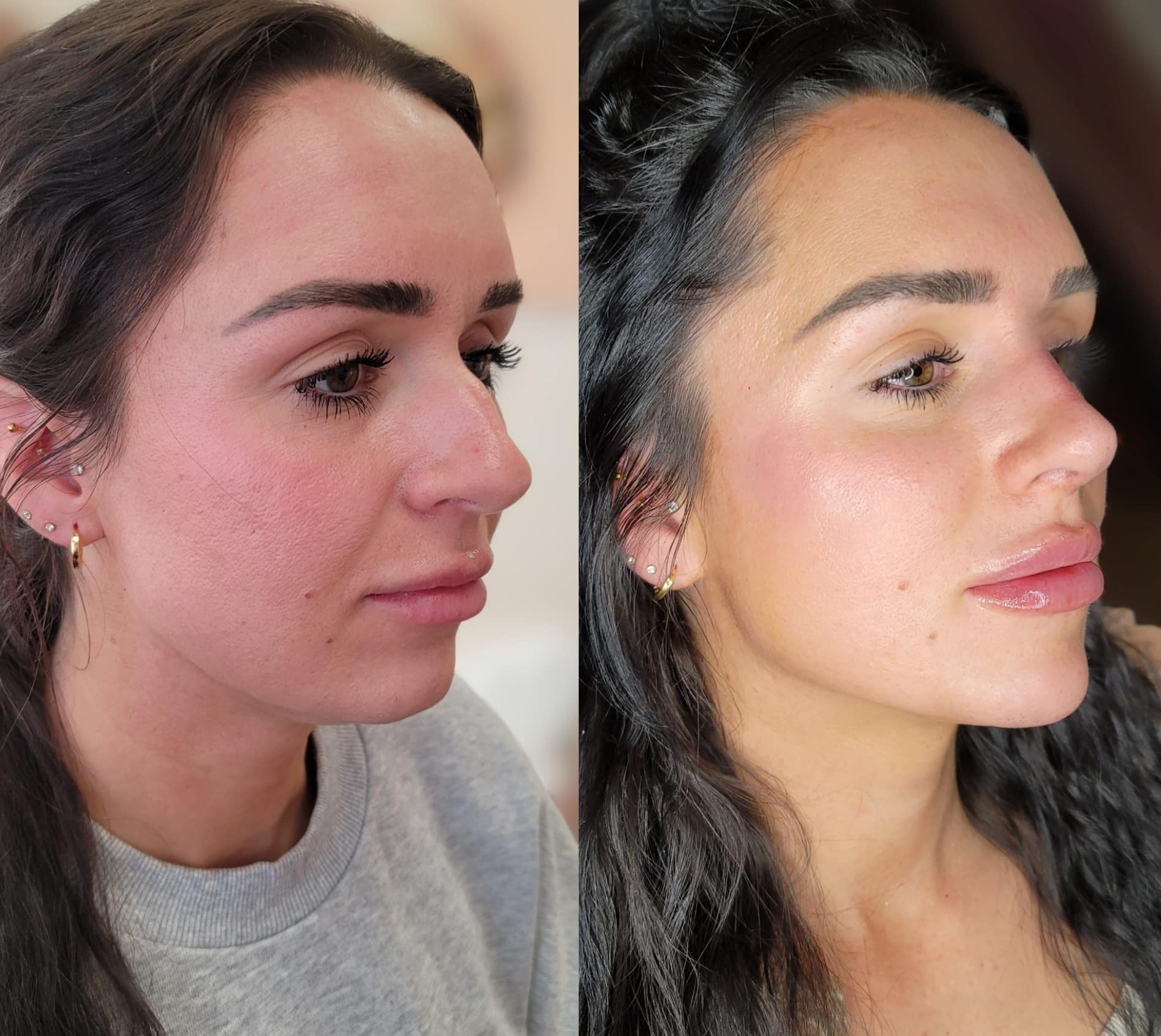 Side-by-side profile photos of a woman with dark hair and small earrings, shown against neutral indoor backgrounds.