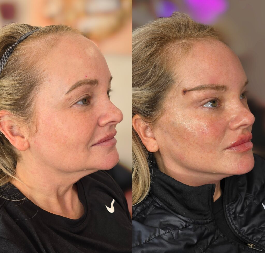 Side-by-side profile portraits of a woman with blonde hair, wearing a black athletic top on the left and a black jacket on the right, against blurred indoor backgrounds.