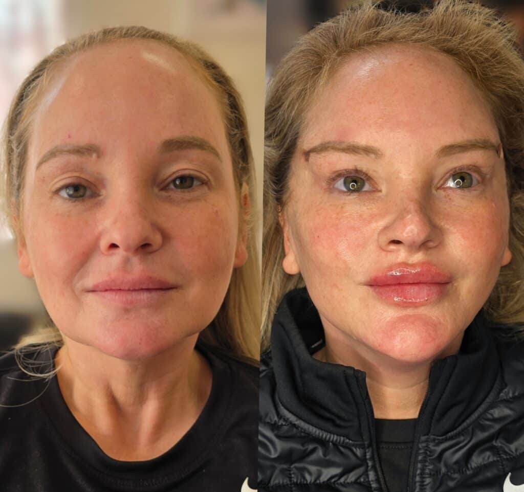A split-screen portrait shows the same woman before and after makeup or skincare, with a blurred indoor background.
