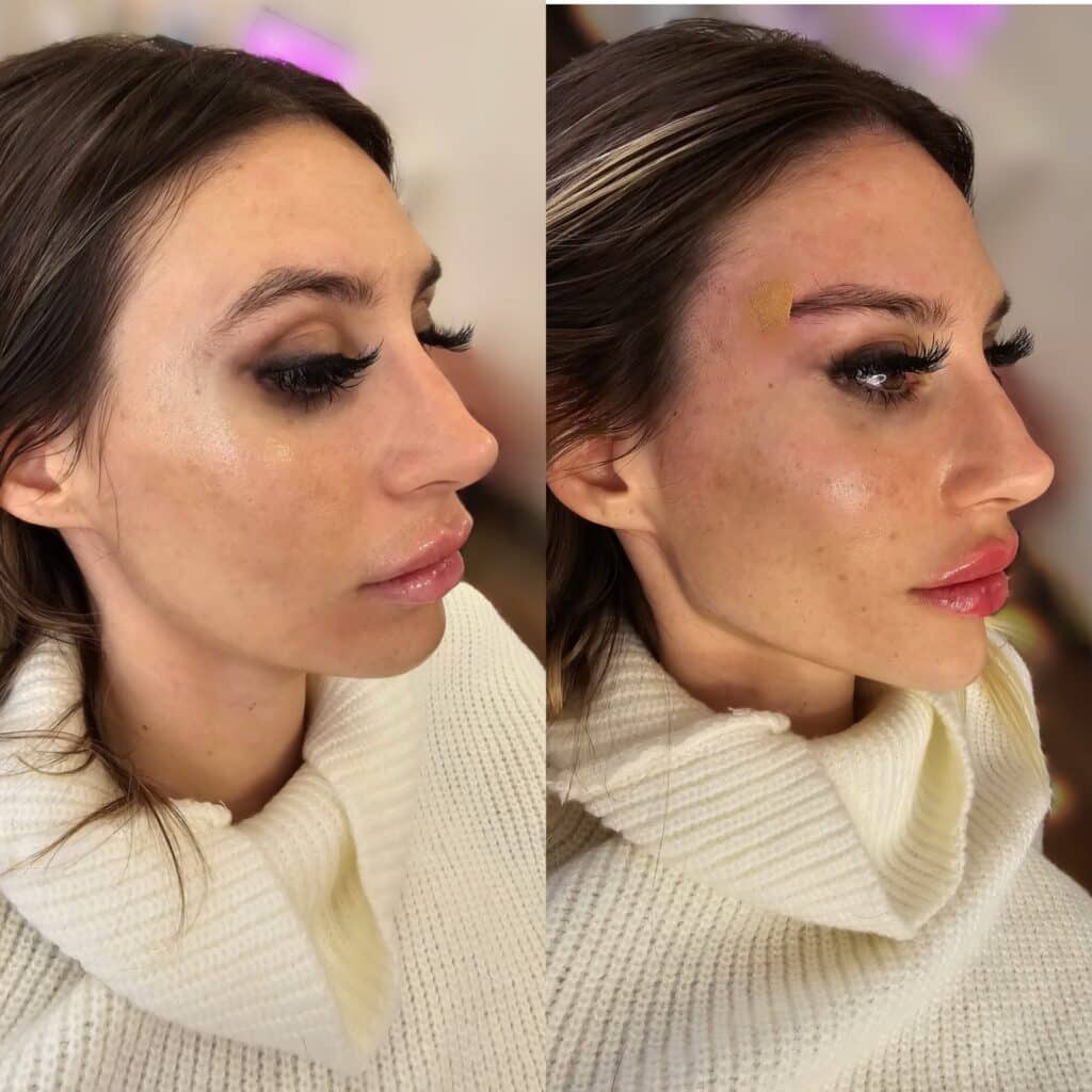 Side-by-side profile portraits of a woman in a cream sweater, with the right image showing a small bandage above her eyebrow against a softly lit indoor background.