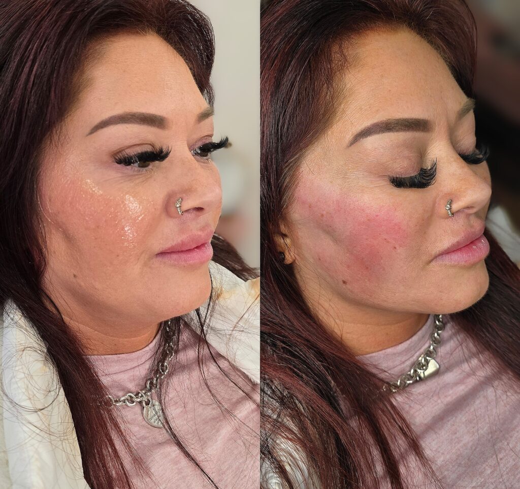Side-by-side close-up profile photos of a woman with dark hair, a nose ring, and long eyelashes wearing a white jacket and pink top.
