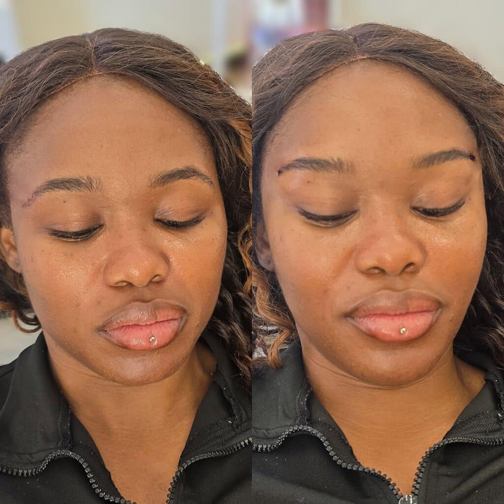 Side-by-side close-up of a woman wearing a black zip-up top with her eyes closed, showing before-and-after facial skin changes.