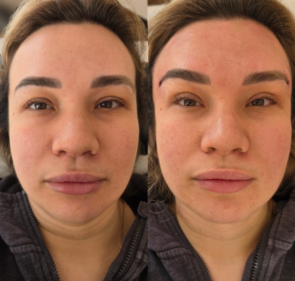 Side-by-side close-up portraits of the same woman lying on a couch, with the image split into two similar views.