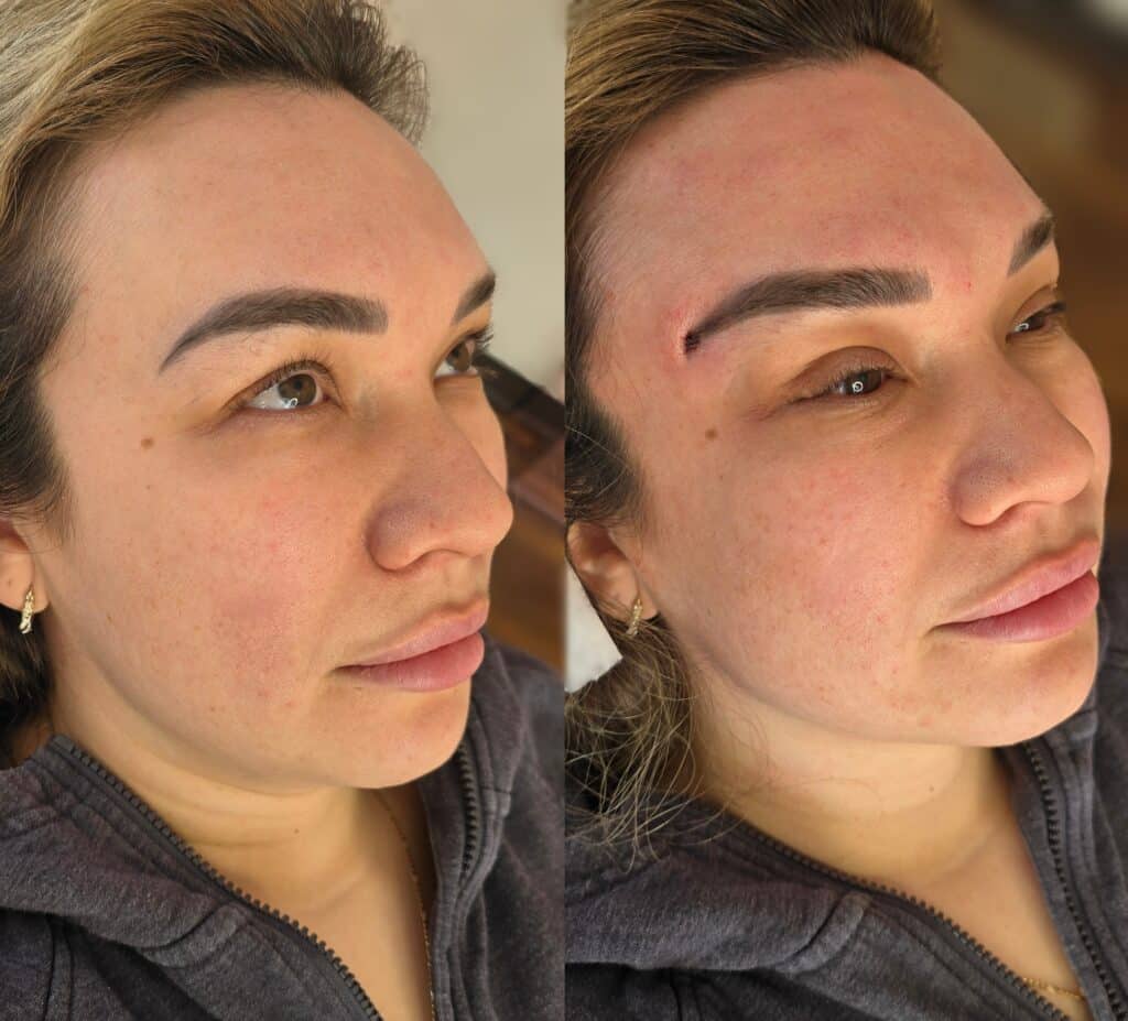 A side-by-side close-up of the same woman with light brown hair and defined eyebrows, wearing a gray hoodie against a plain indoor background.