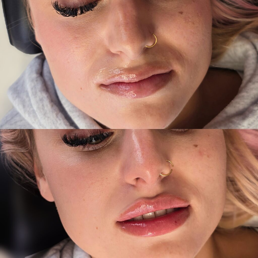 A close-up before-and-after makeup look of a woman with a gold nose ring, shown with bare lips above and glossy pink lips below.