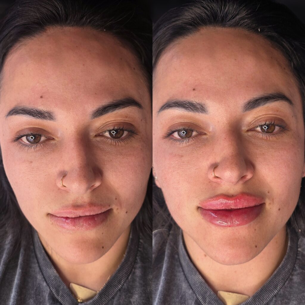 A close-up of a woman's face shown in two side-by-side views, with one portrait showing bare lips and the other showing glossy pink lip color.