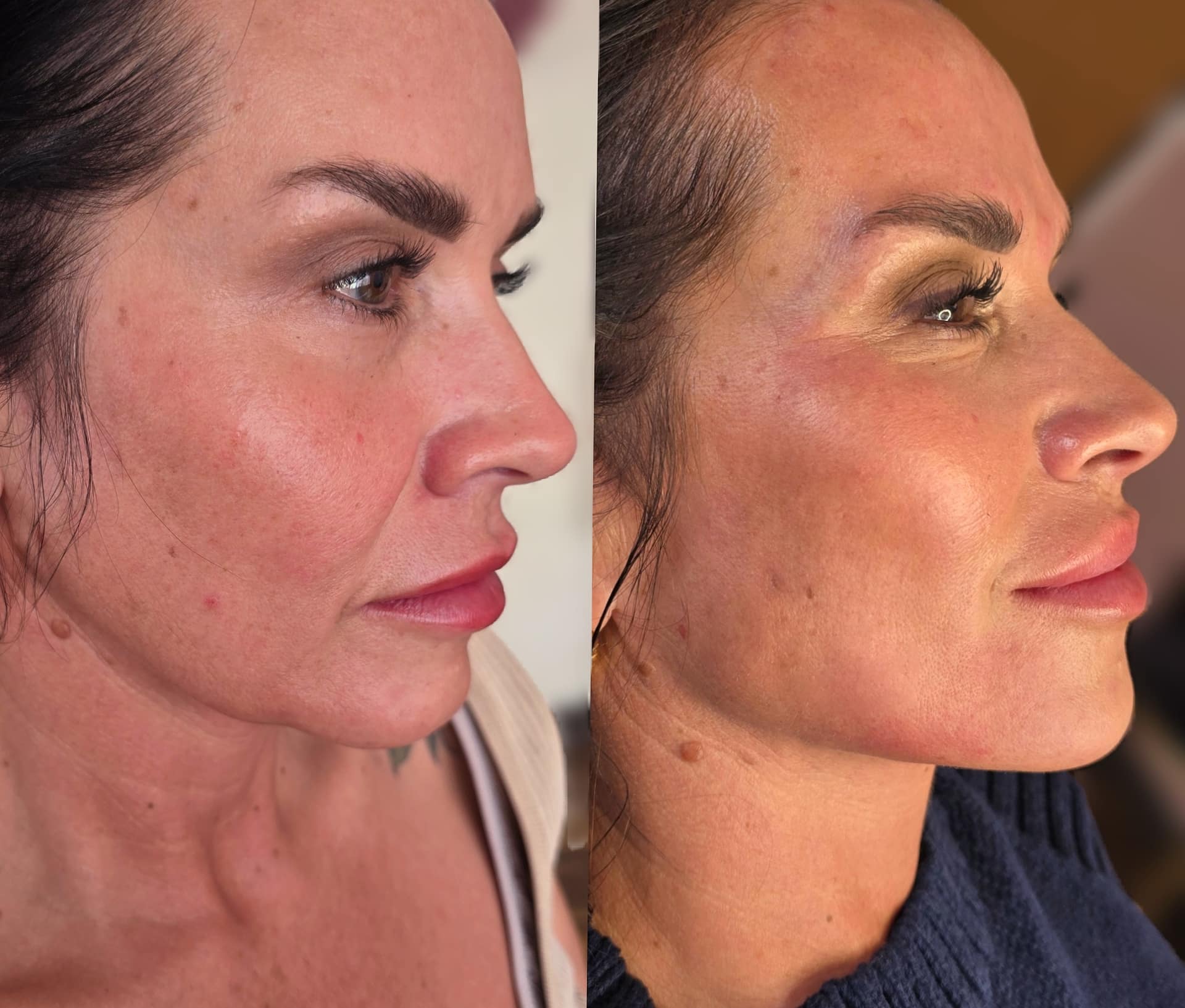 Side-by-side profile photos of the same woman, with the left image in softer indoor light and the right image in warmer lighting.