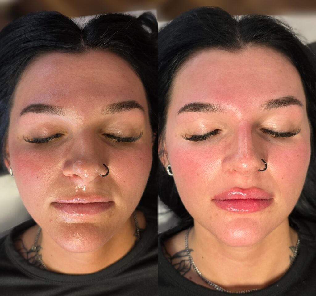 A split-screen close-up shows the same woman lying down with closed eyes and a nose ring, with lighter skin on the left and brighter makeup on the right.