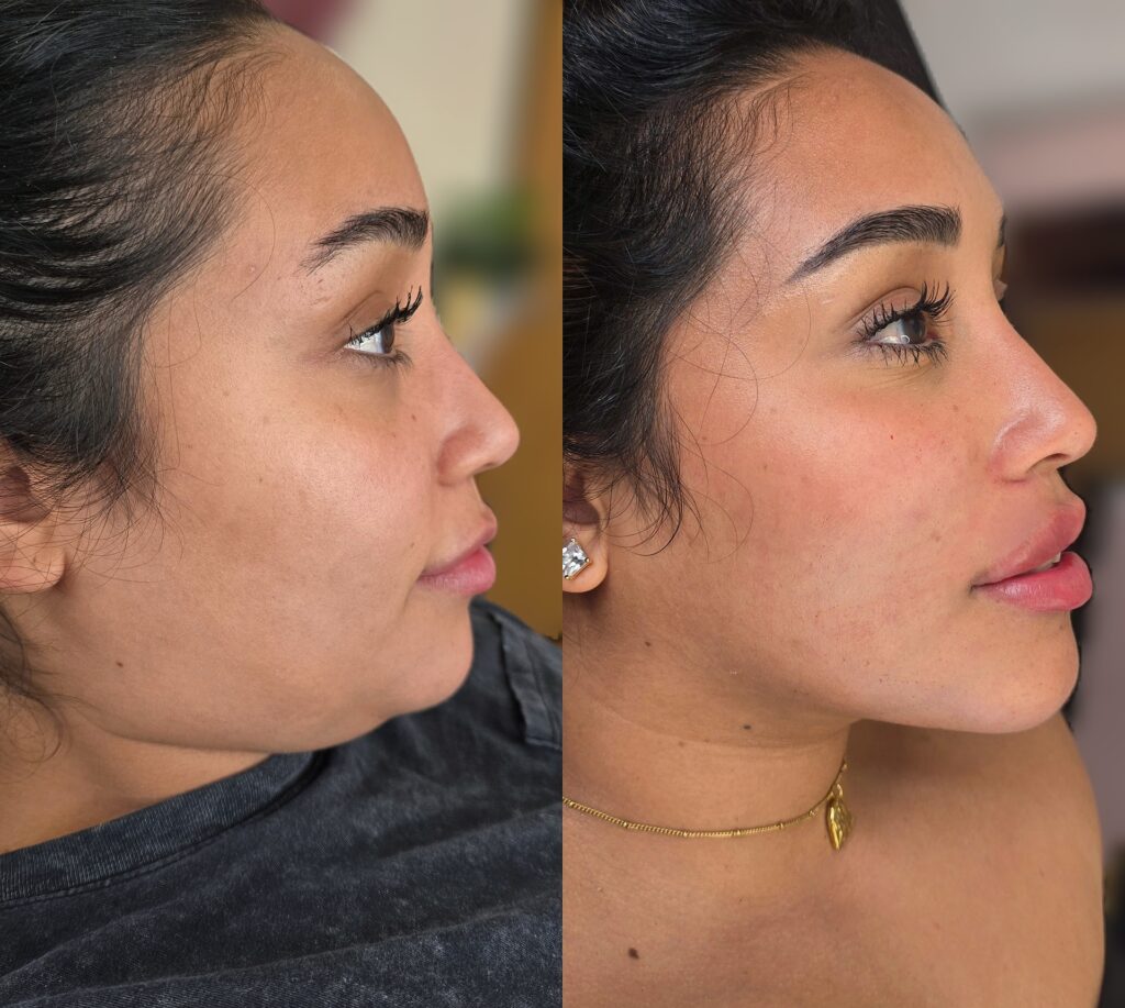 Two side-profile portraits of a woman, with the left image showing a bare face and the right image showing her wearing makeup, earrings, and a gold necklace against a blurred indoor background.