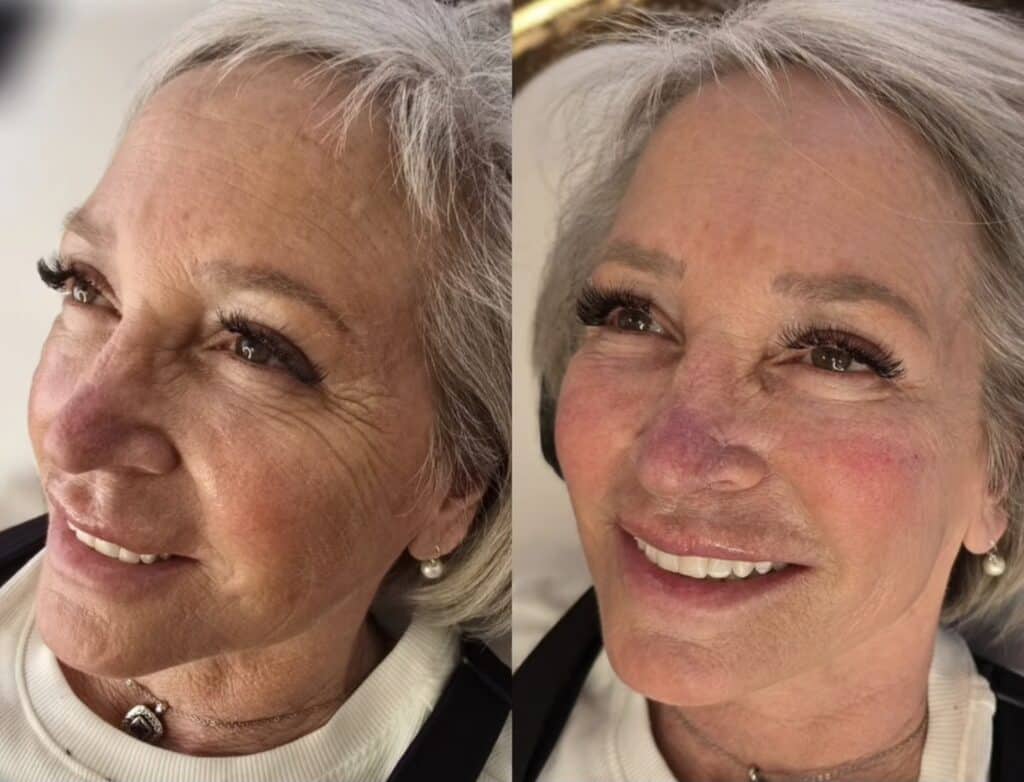 A side-by-side close-up of an older woman with short gray hair and pearl earrings, shown in a black top and a white sweater against a light background.