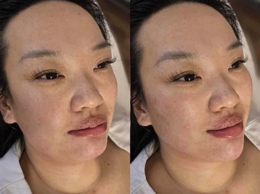 Side-by-side close-up portraits of the same woman with bare skin and closed lips, shown against a dark background.