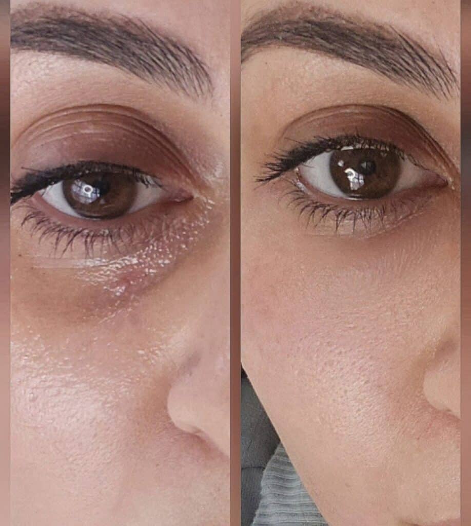 A close-up split image of a woman's eye area and cheek, showing a makeup before-and-after comparison.