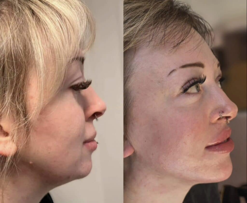 A side-by-side profile of a blonde woman with a nose ring, shown against a plain indoor background.