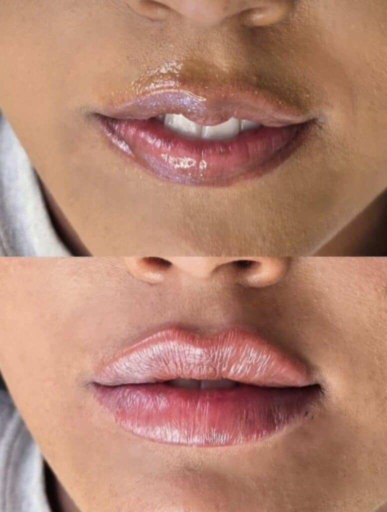 Close-up of the lower face showing glossy lips in a before-and-after comparison, with the top image darker and the bottom image lighter against a white background.