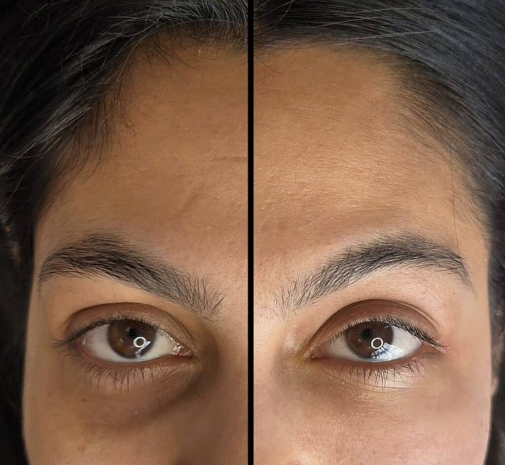 A close-up split image of a woman's eyes and forehead, with darker skin on the left side and lighter skin on the right.