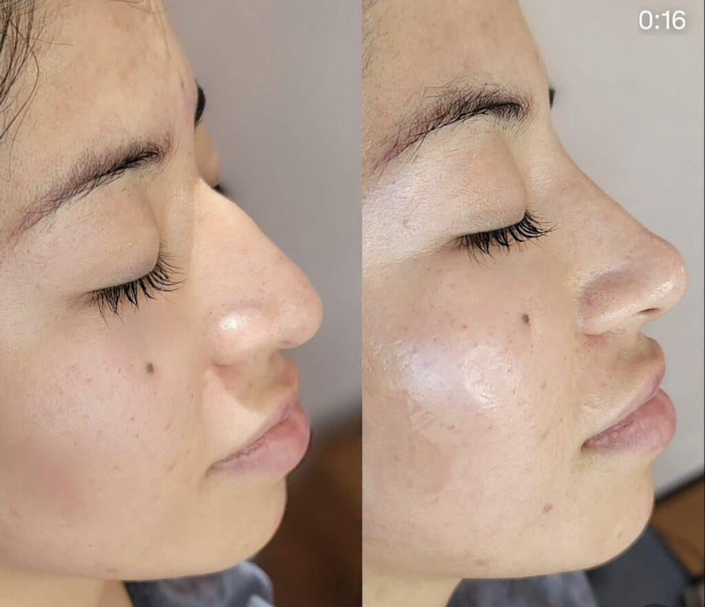 A side-by-side close-up of the same woman’s face in profile, showing closed eyes and smooth skin against a plain indoor background.
