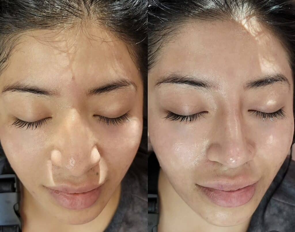 A close-up split image of a woman with closed eyes, showing bare skin on the left and a glossy complexion on the right.