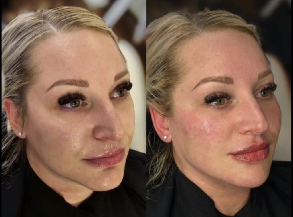 Side-by-side close-up portraits of a blonde woman with makeup, showing a face before and after treatment against a blurred indoor background.