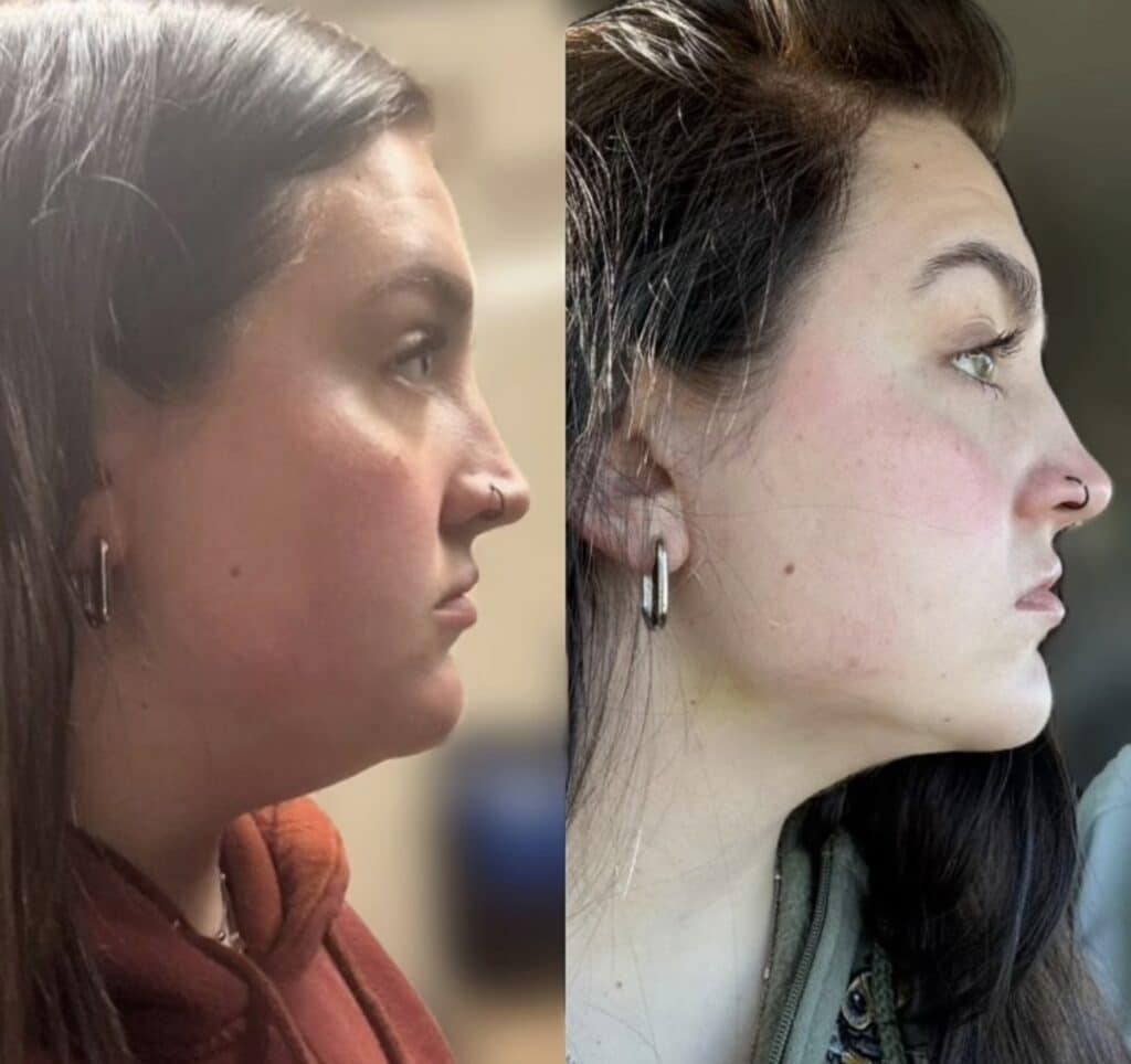Side-by-side profile photos of a woman with dark hair wearing hoop earrings, shown against blurred indoor backgrounds.