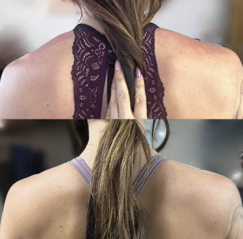 Split image showing a woman’s upper back before and after, with a hand helping align her shoulders while she wears a lace-backed top in the top panel and a purple sports bra in the bottom panel.