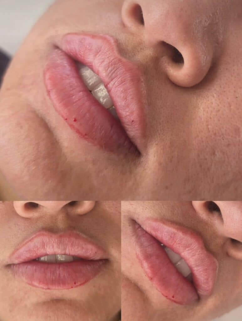 Close-up collage of a person’s lips with visible red lipstick smudging and small cuts, shown from different angles against bare skin.