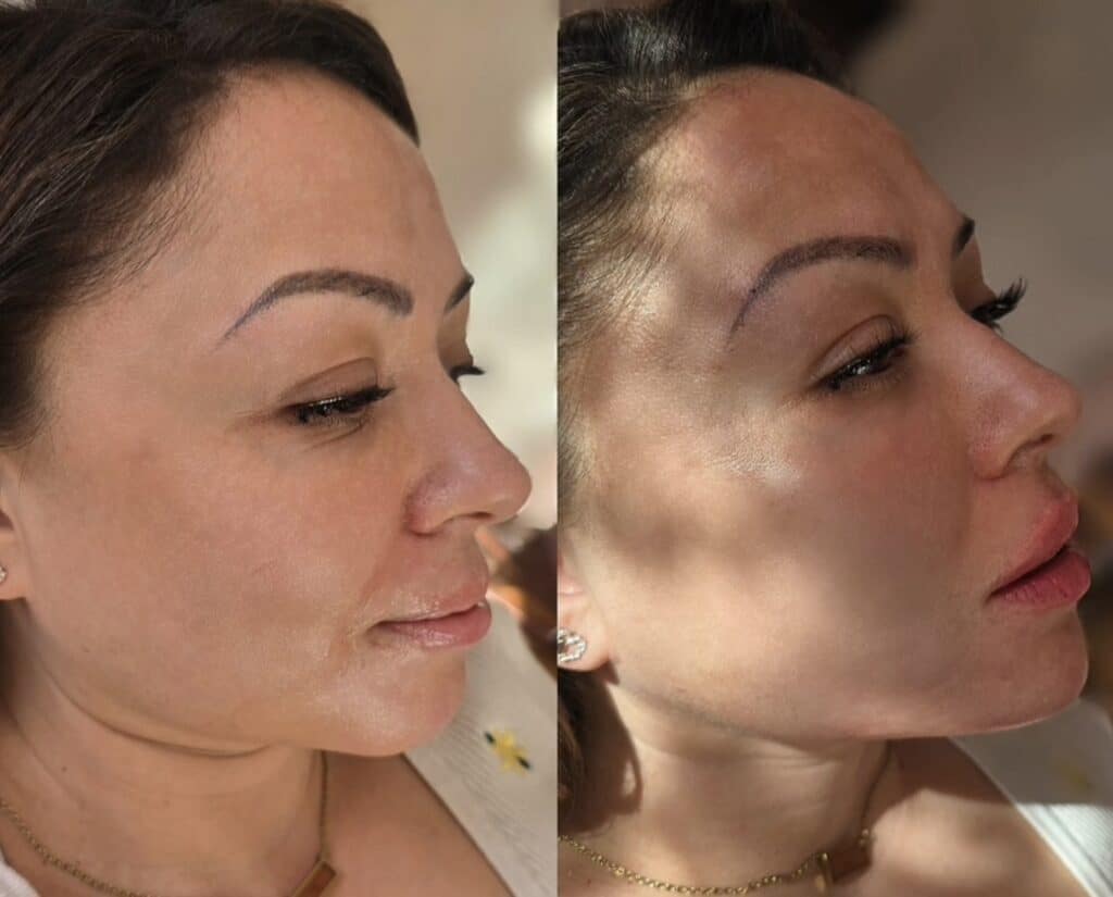 Side-by-side profile photos of the same woman with dark hair, showing her face in natural light against indoor backgrounds.