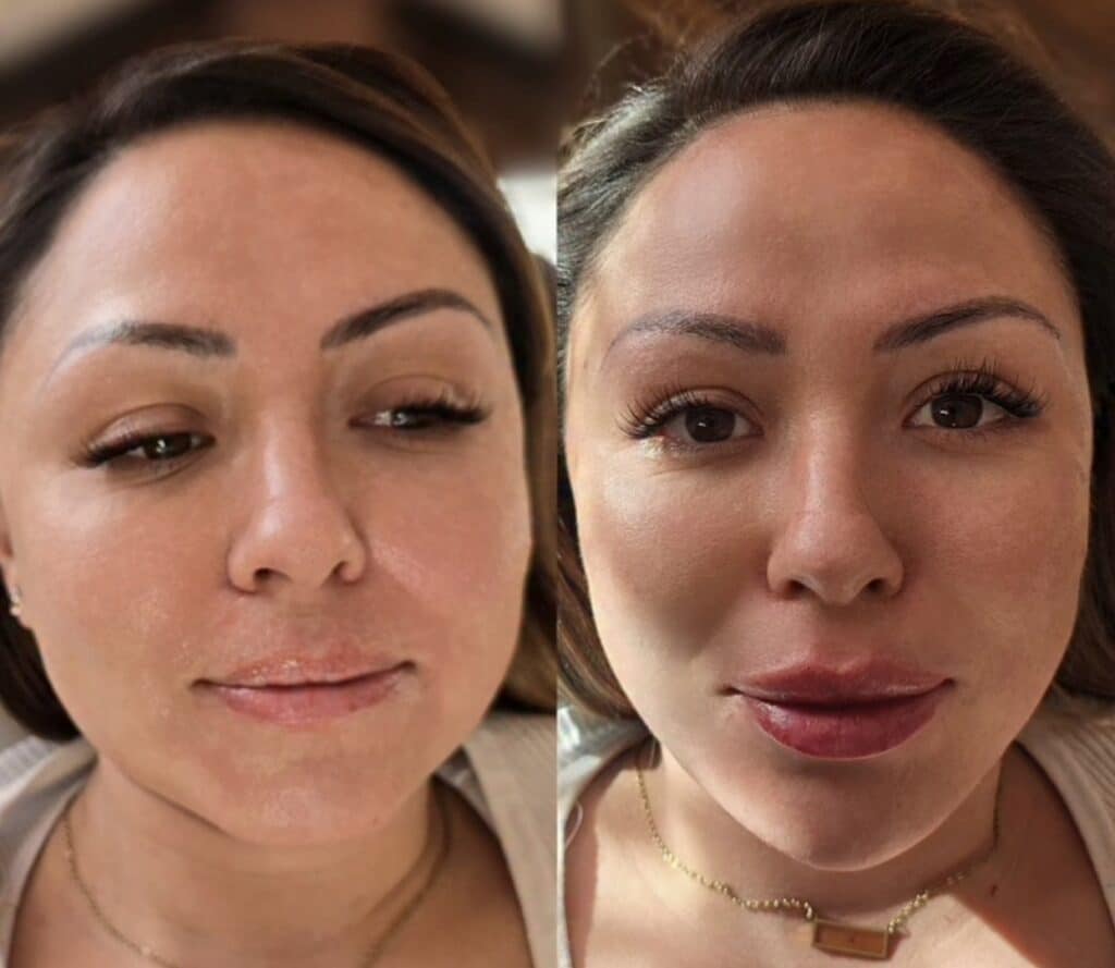 A side-by-side close-up of the same woman’s face, showing a more defined lip shape on the right, with a soft indoor background.