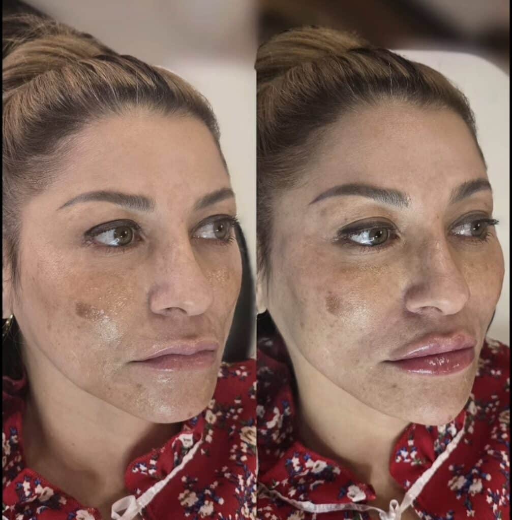 Side-by-side close-up photos of a woman with tied-back hair and a red patterned top, showing visible skin texture variations on her face against a plain indoor background.