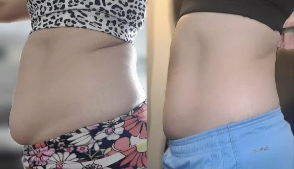 A side-by-side comparison shows a woman’s midsection in patterned shorts on the left and blue pants on the right, with a mirror or split-screen background behind both views.