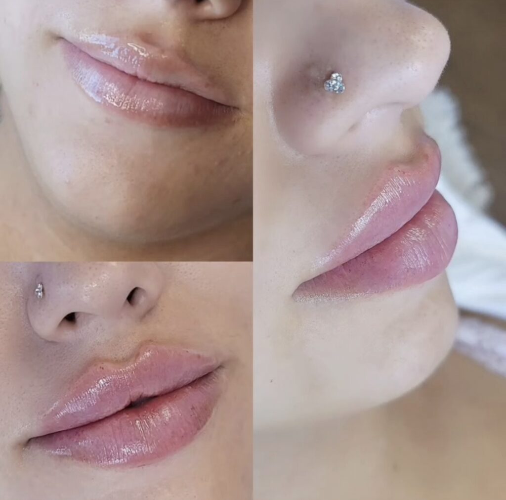 A close-up collage showing a person’s lips and nose with a small nose stud, with glossy pink lipstick and skin visible in three angled views.