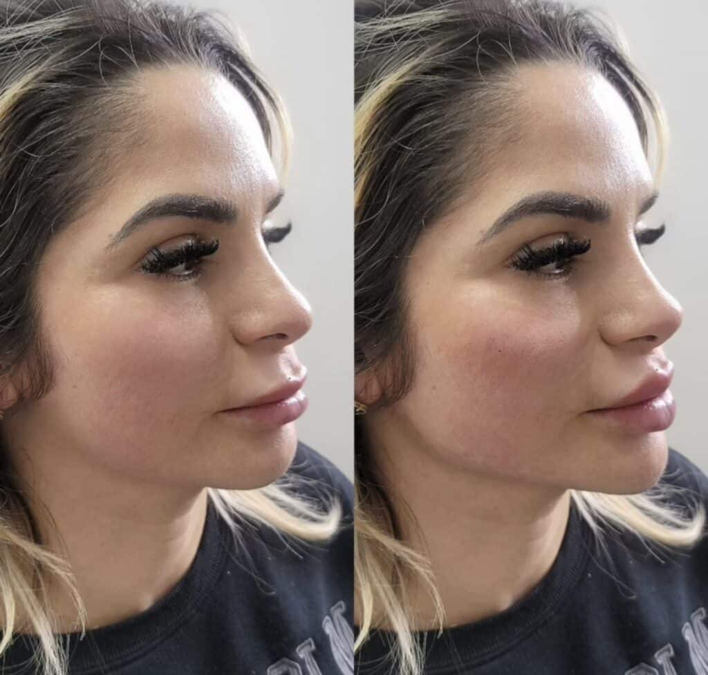 Side-by-side profile photos of a woman with dark eye makeup and blonde hair, shown against a plain light background.