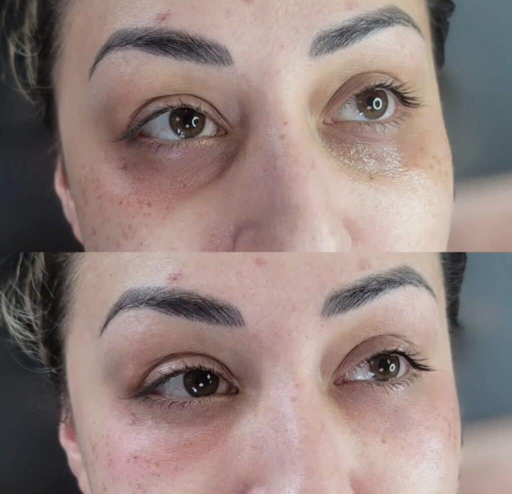 Close-up of a woman’s eyes and eyebrows, shown in a before-and-after split image.