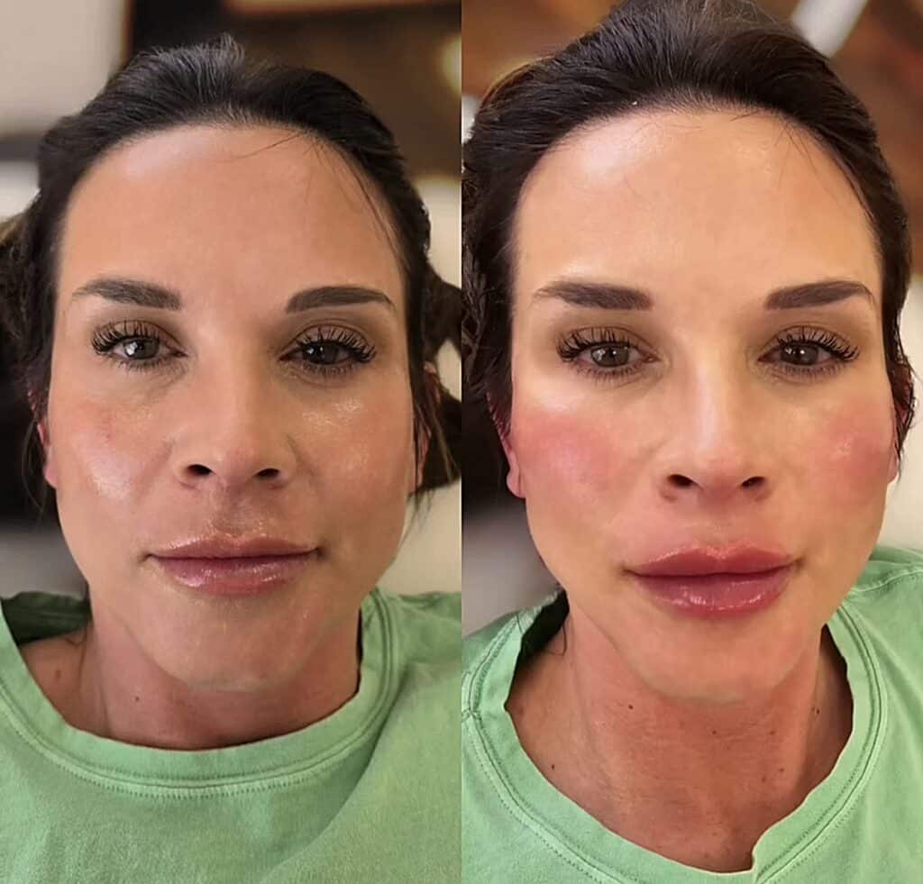 Side-by-side close-up portraits of a woman in a green shirt, with the left image showing a more even complexion and the right image showing flushed cheeks and fuller lips.