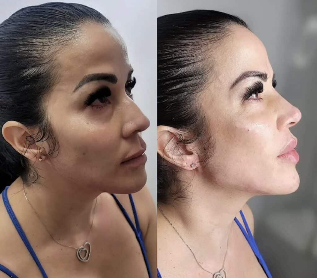 Side-by-side profile photos of a woman with dark hair tied back, wearing a blue strap top and heart pendant necklace, against plain indoor backgrounds.
