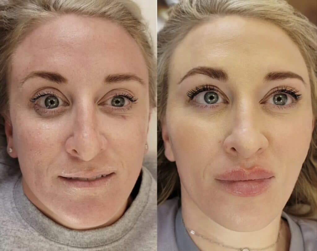 A side-by-side close-up of the same woman lying down, showing one face with bare skin and another with makeup applied against a neutral background.