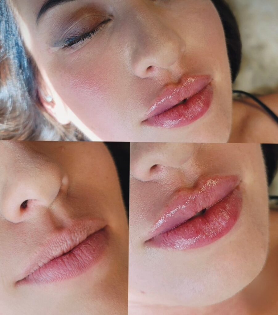 Close-up collage of a woman’s lips and lower face, showing glossy pink lips and soft makeup in three cropped views.