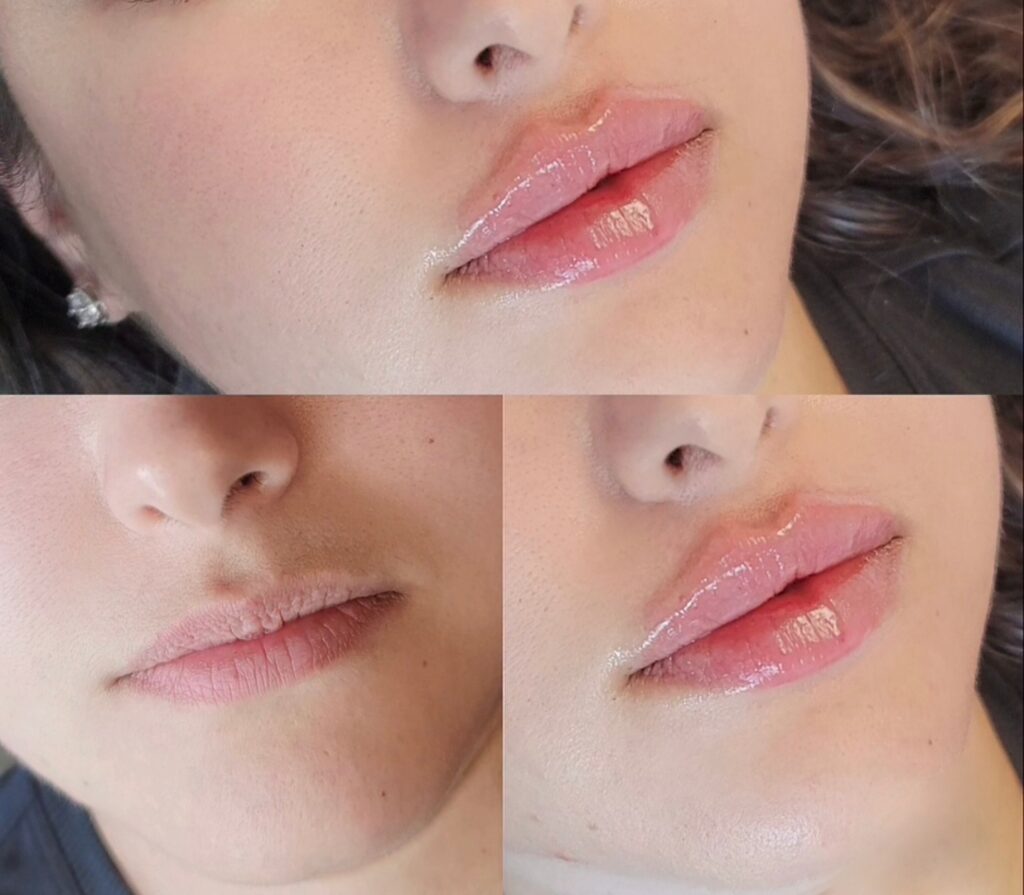 A close-up collage of a woman’s lips and lower face showing natural pink lip gloss and bare skin against a dark background.