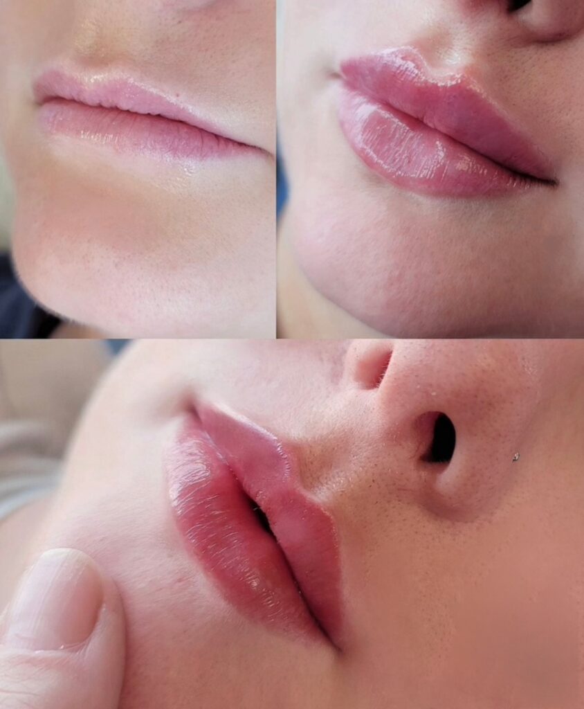 Close-up collage of lips on a face, showing three views with glossy pink lipstick and a hand touching the lower cheek.