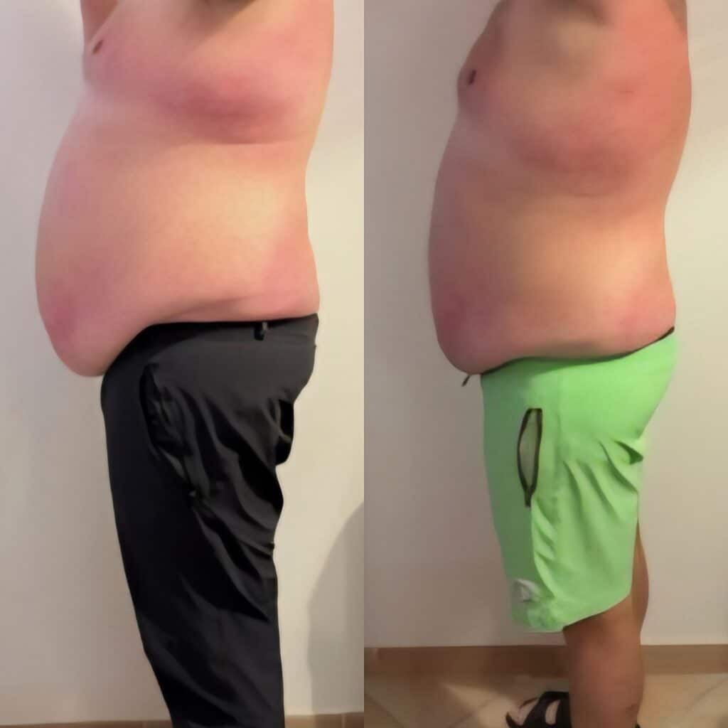 Side-by-side profile views of the same person before and after weight loss, shown against a plain indoor wall and wearing black pants on the left and green shorts on the right.